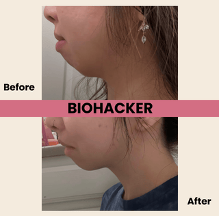Biohackher - Biohackher Mouth Tape