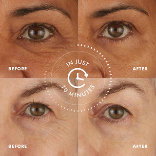 Skyn Iceland - Skyn Iceland Hydro Cool Firming Eye Gels - One Pair